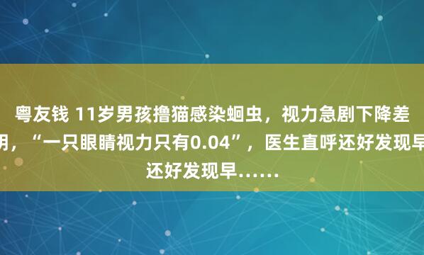 粤友钱 11岁男孩撸猫感染蛔虫，视力急剧下降差点失明，“一只眼睛视力只有0.04”，医生直呼还好发现早……